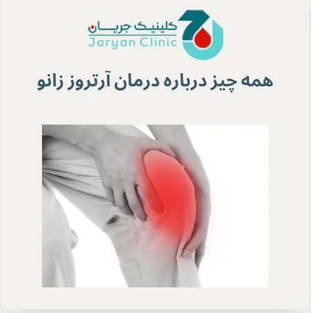 درمان آرتروز زانو چیست؟