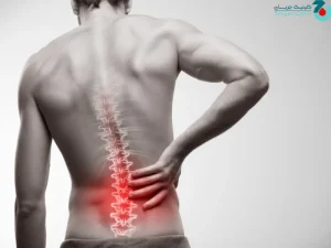 اپیدورال کمردرد