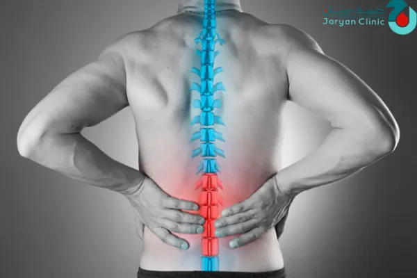 کاربردهای اپیدورال کمردرد