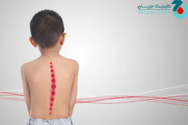 علل کمردرد در کودکان