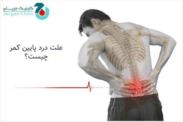 علت درد پایین کمر چیست؟