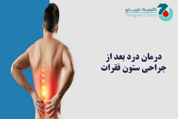 درمان درد بعد از جراحی ستون فقرات چیست؟