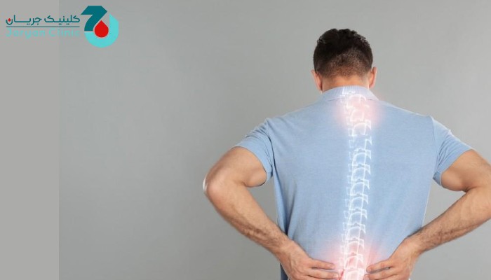 علل کمردرد هنگام ایستادن