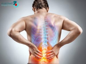 درد بعد از جراحی تنگی کانال نخاع