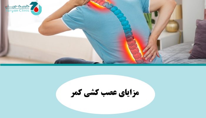مزایای عصب کشی کمر 