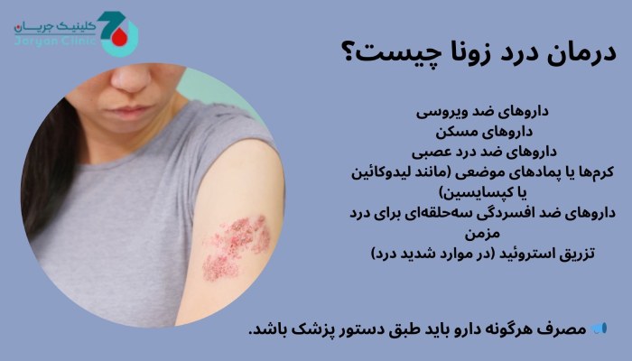 درمان درد زونا چیست؟