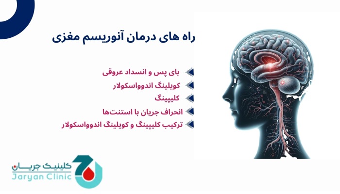 راه های درمان آنوریسم مغزی
