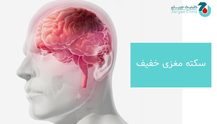 سکته مغزی خفیف چیست؟