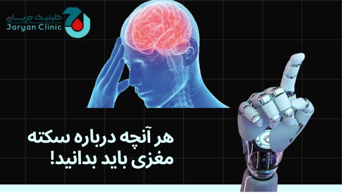 سکته مغزی چیست؟