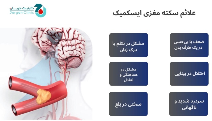علائم سکته مغزی ایسکمیک