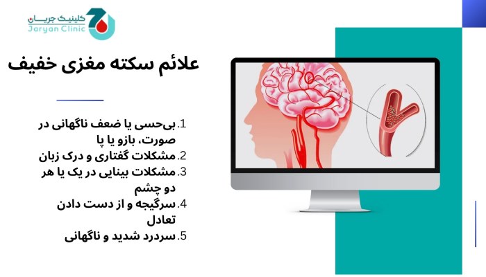 علائم سکته مغزی خفیف چیست؟