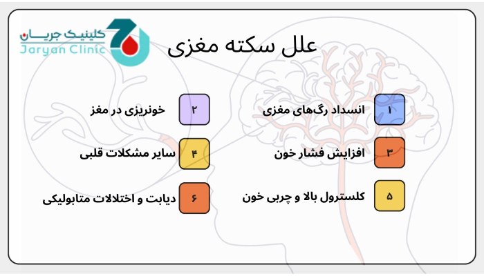 علل سکته مغزی