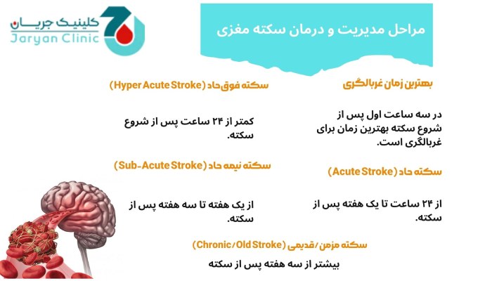 مراحل درمان سکته مغزی