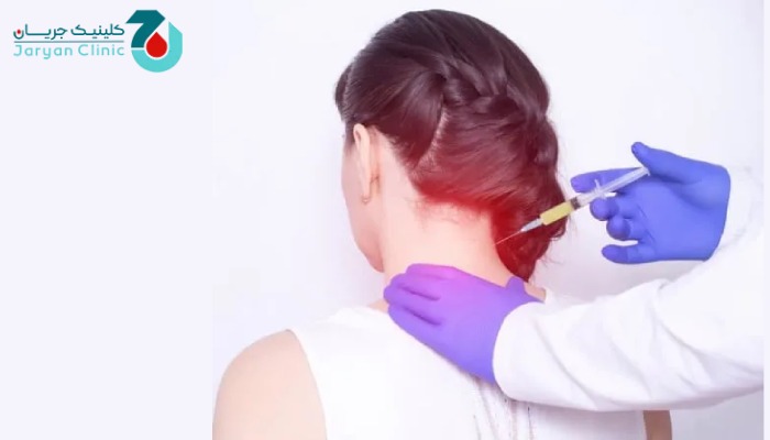 مزایای تزریق اپیدورال گردن