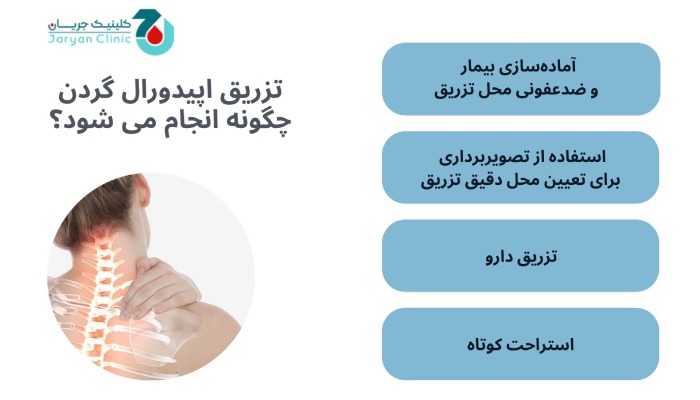 نحوه تزریق اپیدورال گردن