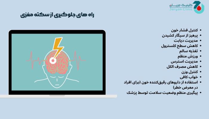 نحوه جلوگیری از سکته مغزی
