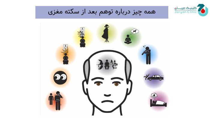 همه چیز درباره توهم بعد از سکته مغزی