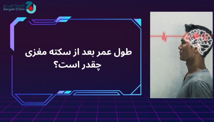 طول عمر بعد از سکته مغزی چقدر است؟