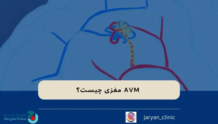  AVM مغزی چیست؟