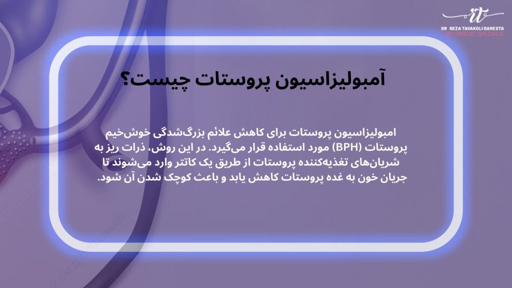 آمبولیزاسیون پروستات چیست