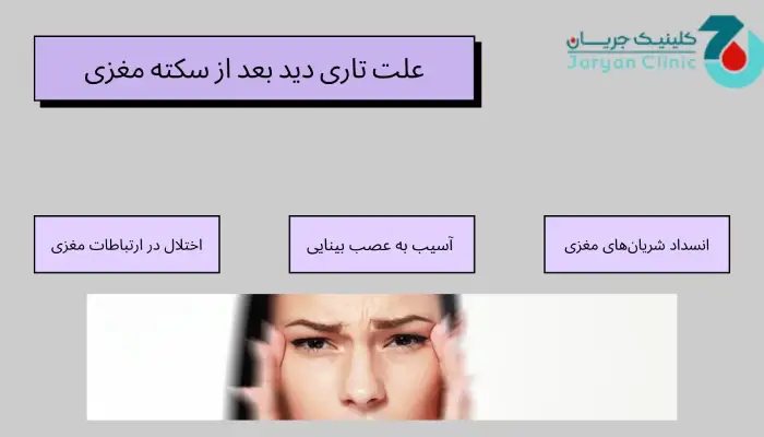 علت تاری دید بعد از سکته مغزی