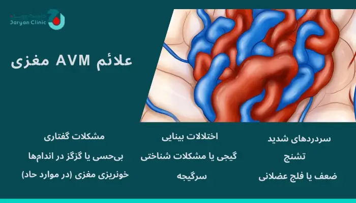 نشانه‌های AVM مغزی