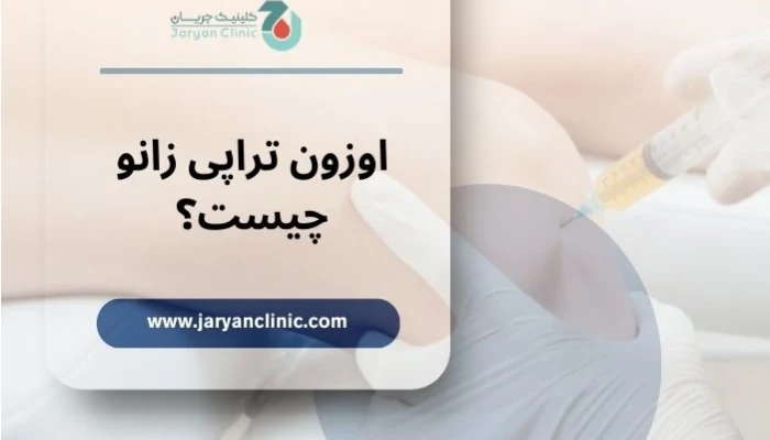 اوزون تراپی زانو چیست؟ 