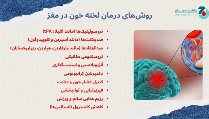 درمان لخته خون در مغز