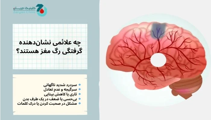 علائم گرفتگی رگ مغز