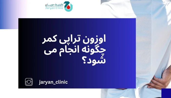 نحوه انجام اوزون تراپی کمر