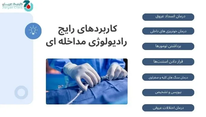 کاربردهای رادیولوژی مداخله ای