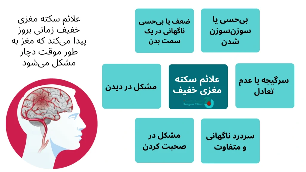 علائم سکته مغزی خفیف چیست