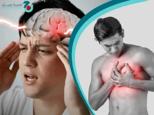 سکته مغزی بعد از سکته قلبی