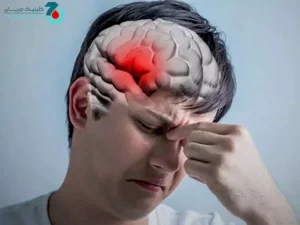 سکته مغزی ناقص