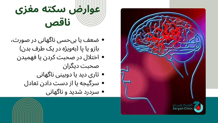 عوارض سکته مغزی ناقص